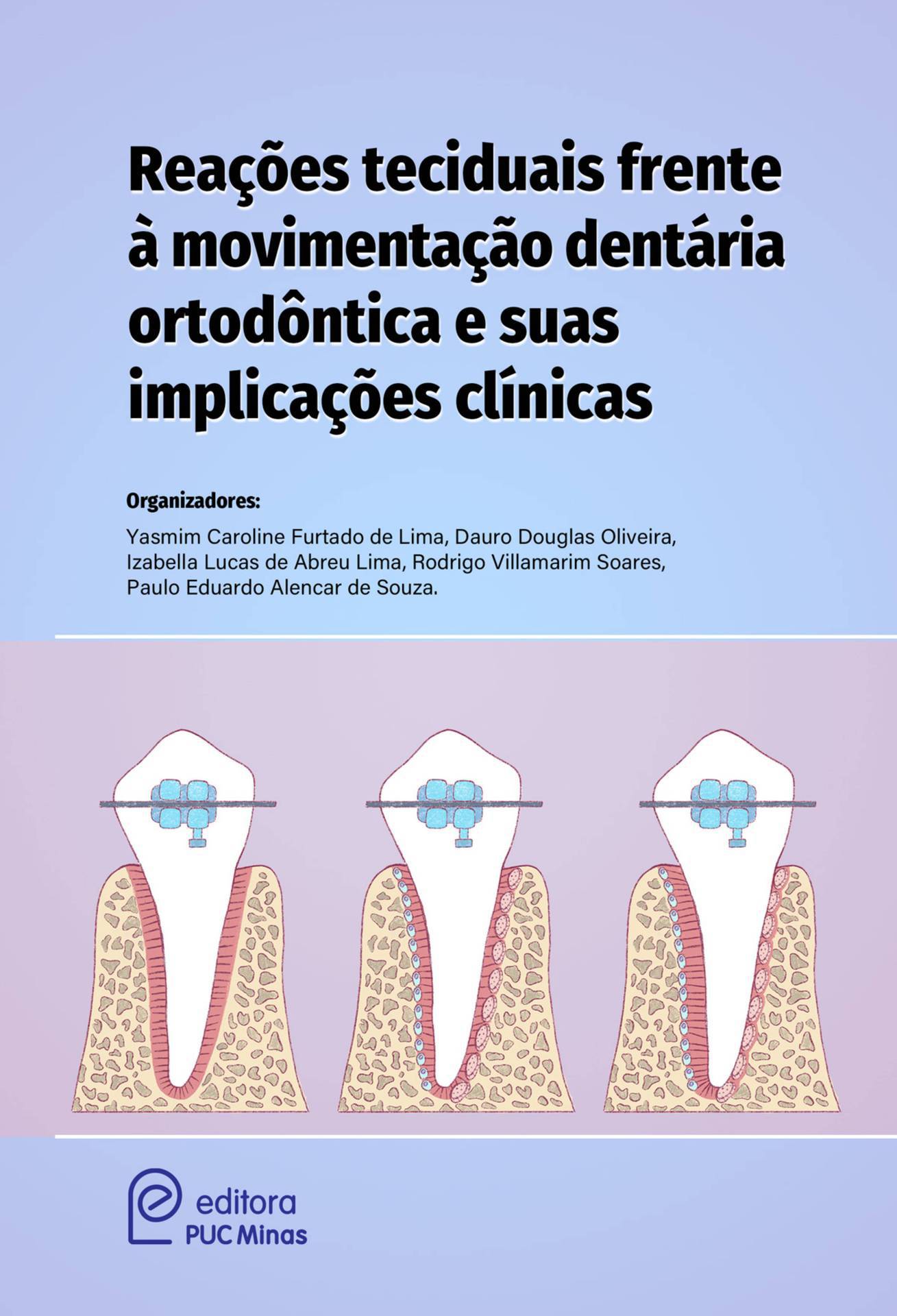 Reações teciduais frente à movimentação dentária ortodôntica e suas implicações clínicas